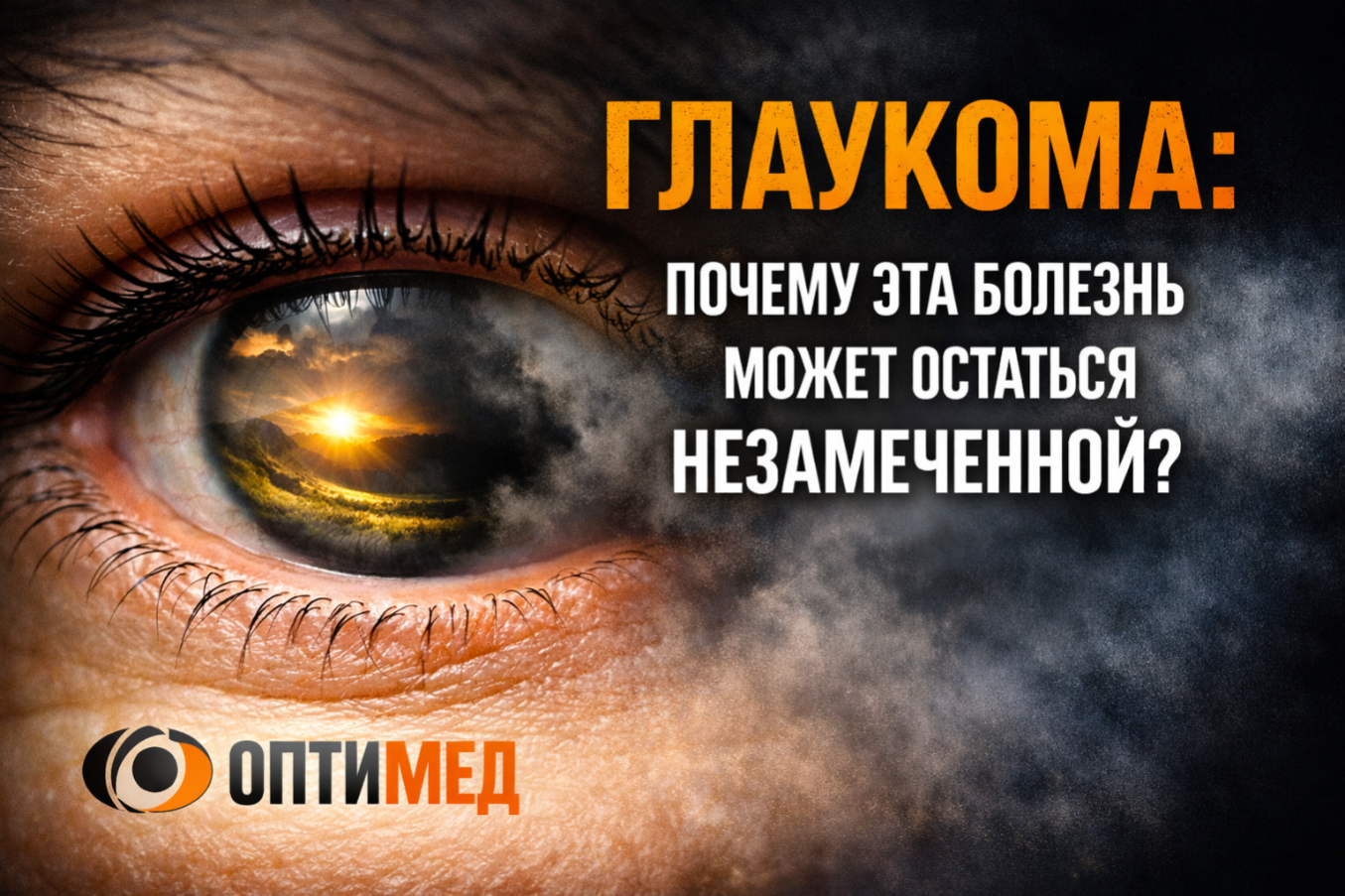 ГЛАУКОМА. Почему эта болезнь может остаться незамеченной?